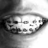 man smiling with braces